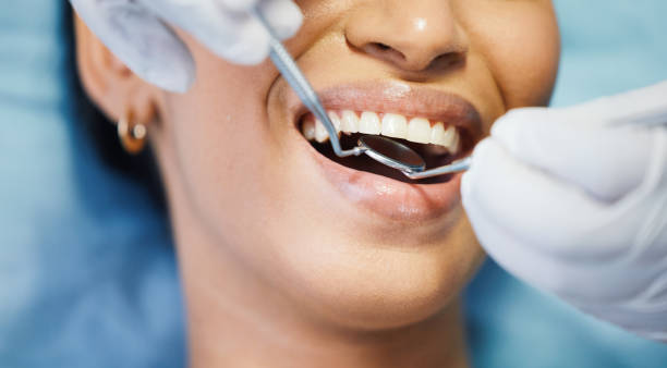 Best Chipped Tooth Repair Near Me  in Rolla, MO